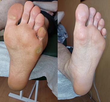 Мужской педикюр